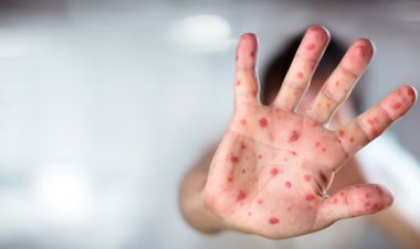 OKULLAR AÇILDIĞINDA BULAŞ DAHA DA ARTACAK!