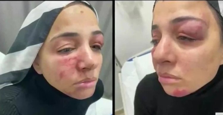 ŞİDDET MAĞDURU KADIN, DEVLETTEN YARDIM BEKLİYOR!